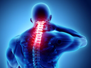 Injury Lawyers Charlottesville VA - Neck painful - cervical spine skeleton x-ray, 3D illustration