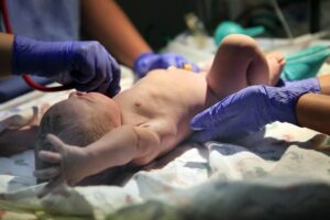 Understanding Birth Injury Claims